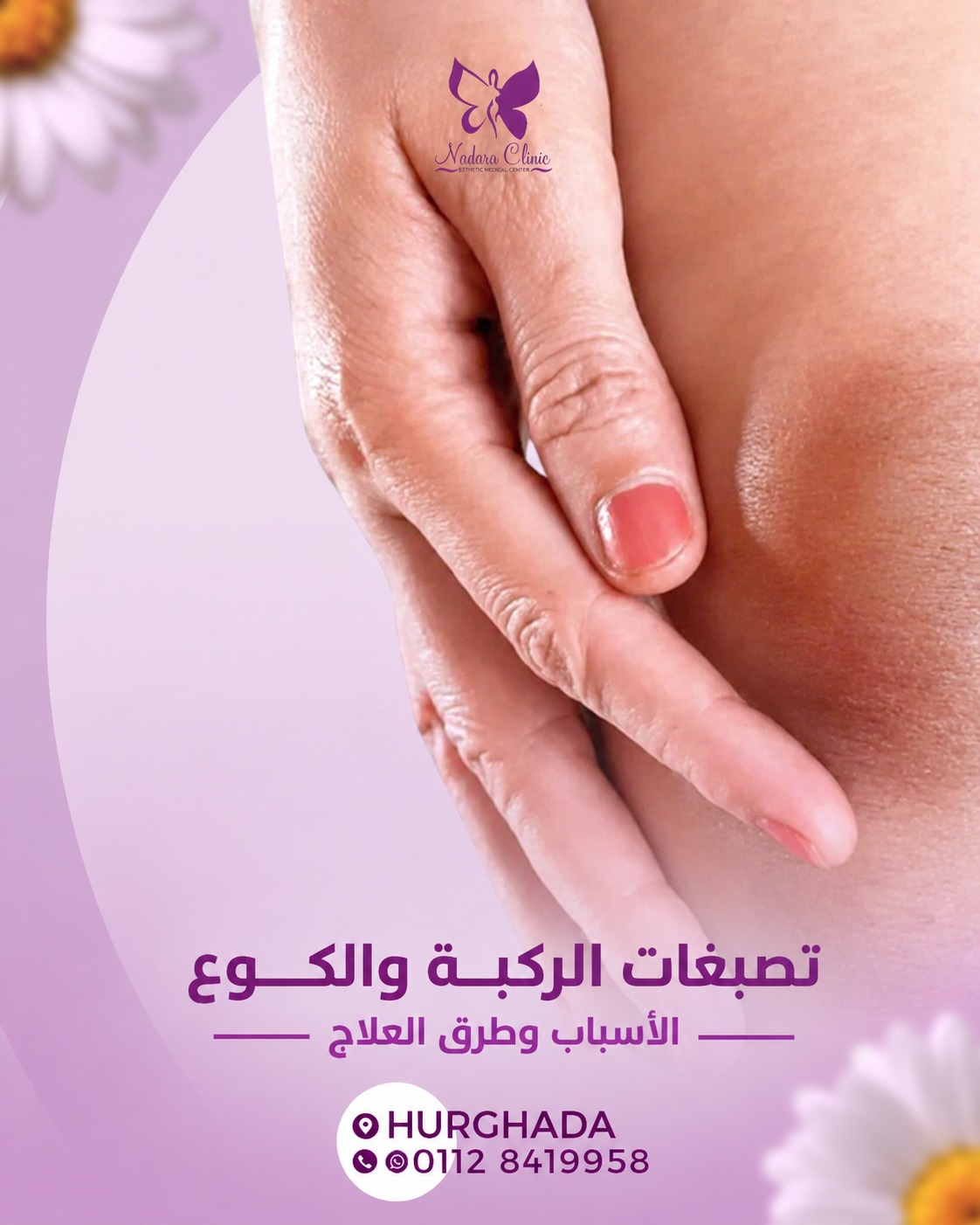 تصبغات الركبة والكوع الأسباب وطرق العلاج في الغردقة